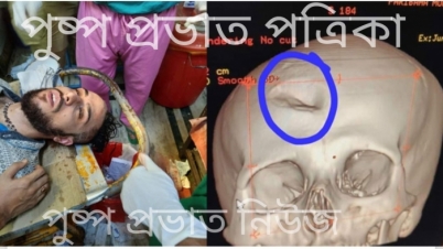 মেডিকেল কলেজের বহির্বিভাগের বনধের ডাক জুনিয়র ডক্টরসদের